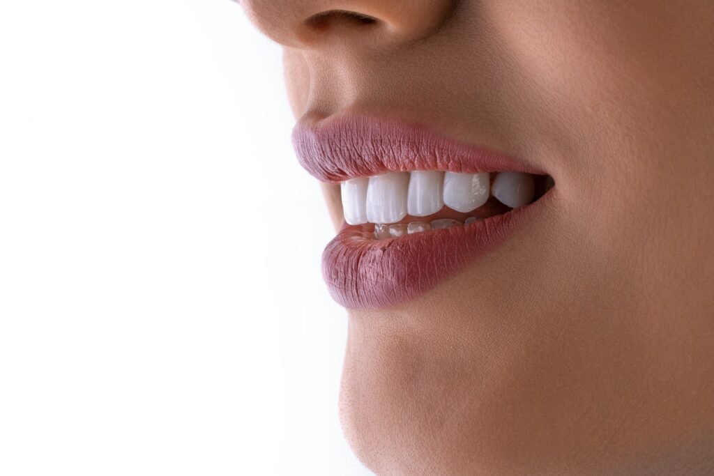Blanqueamiento dental en Las Palmas de Gran Canaria | Clínica Dental Santana