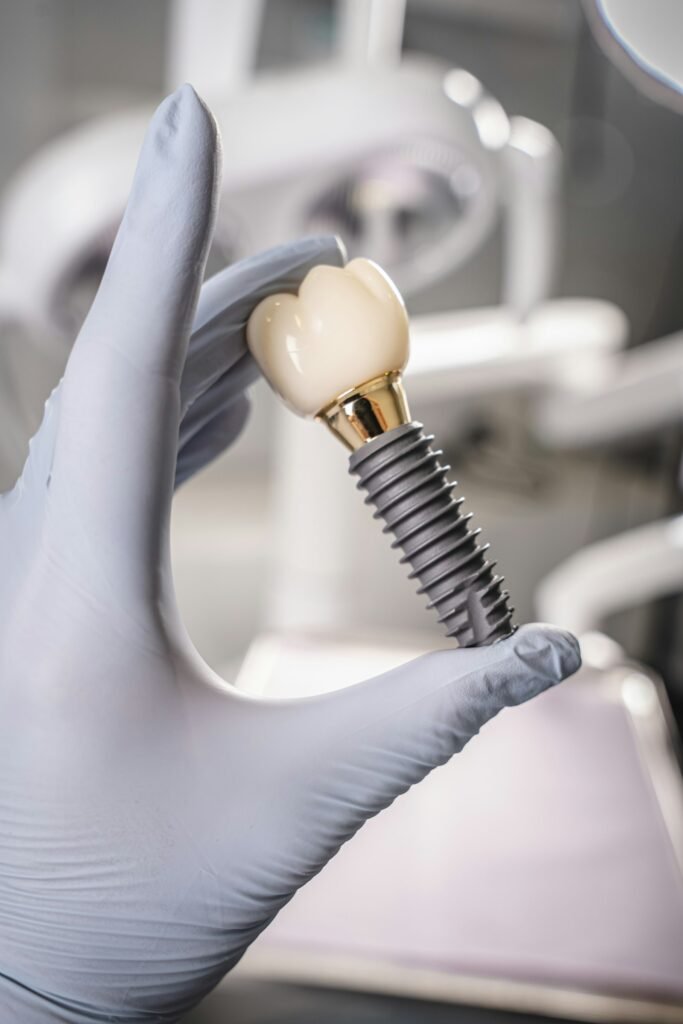 Implantes dentales en Las Palmas de Gran Canaria | Clínica Dental Santana