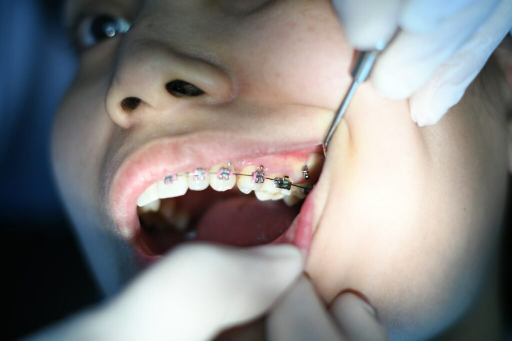 Ortodoncia en Las Palmas de Gran Canaria | Clínica Dental Santana